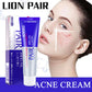 Pair Acne Cream