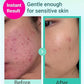 Bring Green Tea Tree Cica Trial Kit