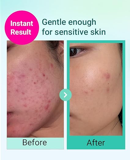 Bring Green Tea Tree Cica Trial Kit