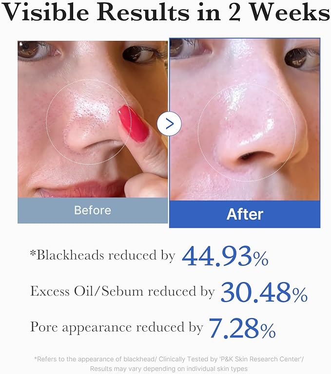 Medicube Zero Pore Pad 155g