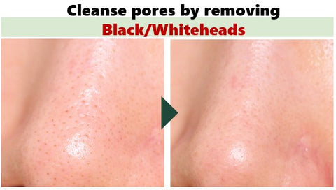 Neogen Pore Tight Peeling Mousse